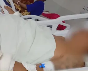 Imagem ilustrativa da imagem Paciente em surto tem acesso a bisturi e mutila genitais dentro da Restauração