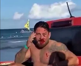 Imagem ilustrativa da imagem ‘Teve motivação homofóbica’, diz casal de turistas agredido em praia de Porto de Galinhas