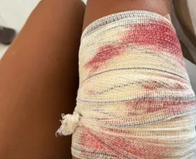 Imagem ilustrativa da imagem Turista de SP é mordida por tubarão ao mergulhar em Fernando de Noronha