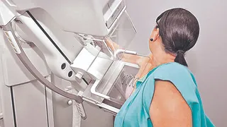 Imagem ilustrativa da imagem Lei garante mamografia pelo SUS para mulheres a partir dos 40 anos