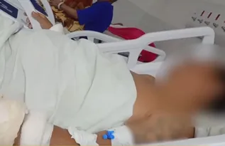 Imagem ilustrativa da imagem Paciente em surto tem acesso a bisturi e mutila genitais dentro da Restauração