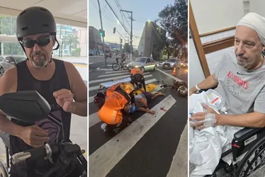 Imagem ilustrativa da imagem Chef de cozinha faz alerta após acidente com moto elétrica: "Usem capacete"