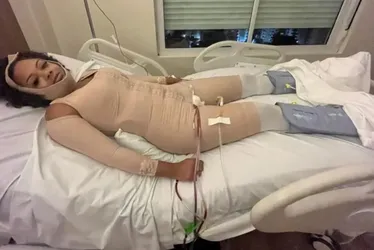 Imagem ilustrativa da imagem “Cirurgia X-Tudo”: Médico é condenado a 5 anos por deformar paciente