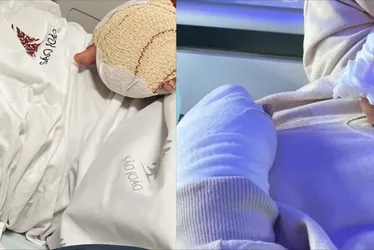 Imagem ilustrativa da imagem Estudante brasileiro de 9 anos tem dois dedos decepados em escola de Portugal