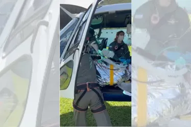 Imagem ilustrativa da imagem Homem tem 25% do corpo queimado após tentar acender churrasqueira no Sul do ES