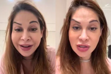 Imagem ilustrativa da imagem Maíra Cardi exibe rosto deformado após botox dar errado: 'Olha que palhaçada'