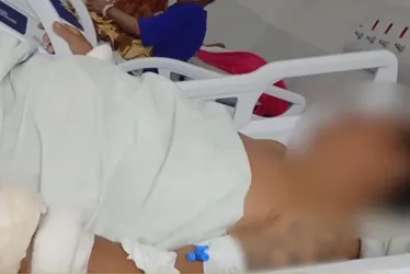 
          Imagem ilustrativa da imagem Paciente em surto tem acesso a bisturi e mutila genitais dentro da Restauração
          