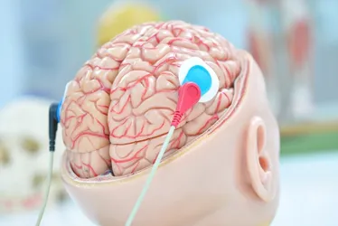 Imagem ilustrativa da imagem Unesco faz recomendação inédita para uso ético da neurotecnologia