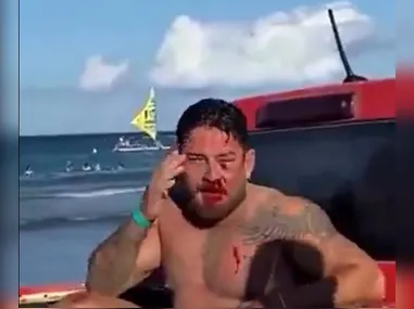 Imagem ilustrativa da imagem ‘Teve motivação homofóbica’, diz casal de turistas agredido em praia de Porto de Galinhas