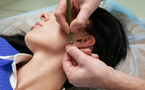 
          Imagem ilustrativa da imagem 57 cirurgias de correções de orelhas foram feitas pelo SUS este ano no ES
          