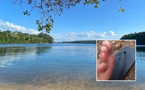 
          Imagem ilustrativa da imagem Banhistas relatam mordidas e temem presença de piranhas em lagoa de Linhares
          