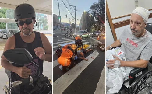 
          Imagem ilustrativa da imagem Chef de cozinha faz alerta após acidente com moto elétrica: "Usem capacete"
          