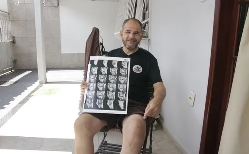 
          Imagem ilustrativa da imagem ES bate recorde e 162 mil pacientes fazem cirurgia pelo SUS este ano
          