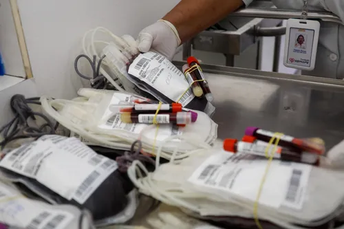 
          Imagem ilustrativa da imagem Hemope inicia campanha de carnaval para incentivar doação de sangue
          