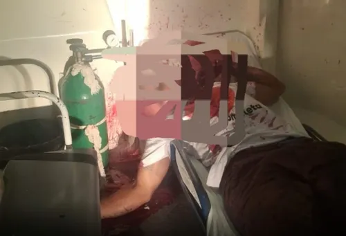 
          Imagem ilustrativa da imagem Homem com tornozeleira eletrônica é executado dentro de ambulância em Canhotinho-PE
          