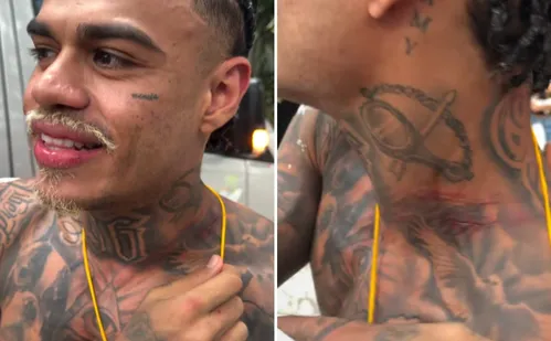 
          Imagem ilustrativa da imagem MC Cabelinho fica com pescoço machucado após tentativa de furto em Salvador
          