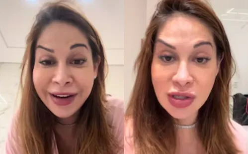
          Imagem ilustrativa da imagem Maíra Cardi exibe rosto deformado após botox dar errado: 'Olha que palhaçada'
          