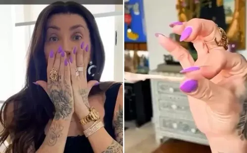 
          Imagem ilustrativa da imagem Maya Massafera mostra resultado após retirar ossos do rosto
          