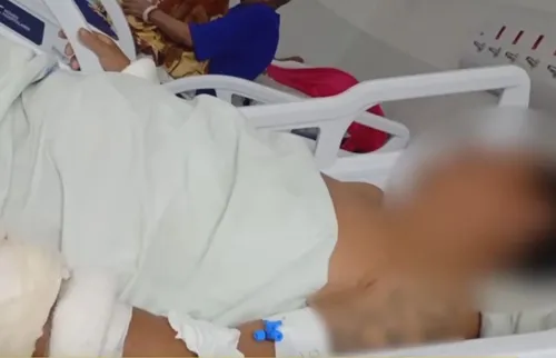 
          Imagem ilustrativa da imagem Paciente em surto tem acesso a bisturi e mutila genitais dentro da Restauração
          