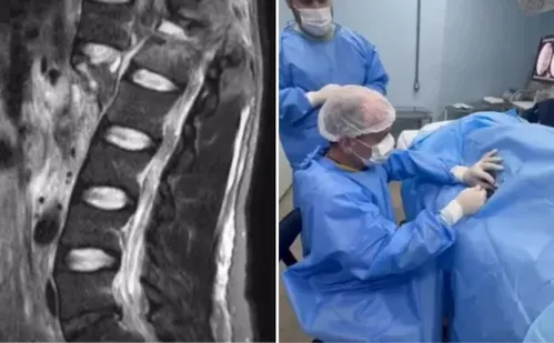 
          Imagem ilustrativa da imagem Paciente que recebeu polilaminina relata emoção ao mexer o pé e a perna
          