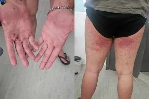 
          Imagem ilustrativa da imagem Pico Paraná: irmã mostra imagens das lesões do jovem que ficou desaparecido por 4 dias em trilha
          