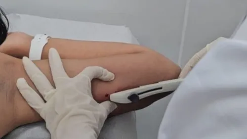 
          Imagem ilustrativa da imagem Recife amplia acesso a implante contraceptivo sob a pele na rede municipal de saúde
          