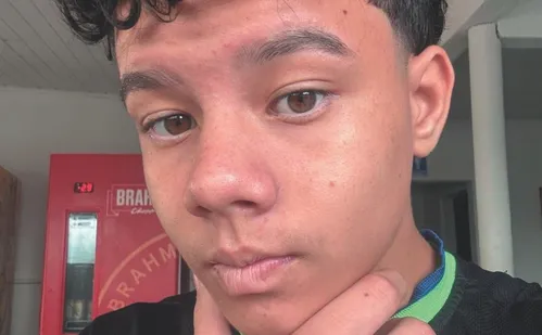 
          Imagem ilustrativa da imagem Samu já atendeu 114 vítimas de acidentes com bikes elétricas no ES este ano
          