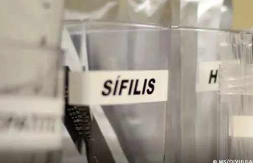 
          Imagem ilustrativa da imagem Sífilis avança entre gestantes e faz Pernambuco liderar taxas no Nordeste
          