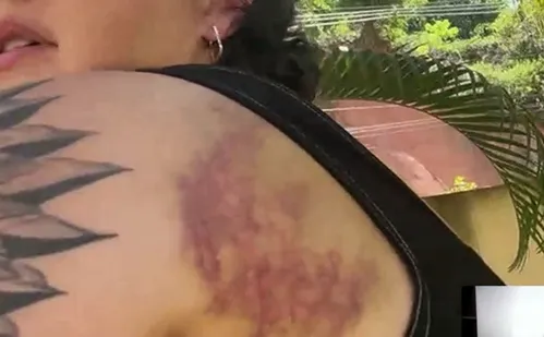 
          Imagem ilustrativa da imagem Socorrista é agredida quando saía de um bar no Norte do Espírito Santo
          