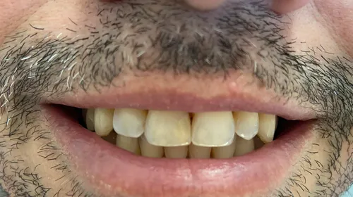 
          Imagem ilustrativa da imagem Sorriso novo em poucas horas
          