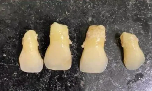 
          Imagem ilustrativa da imagem Sorriso novo em poucas horas
          