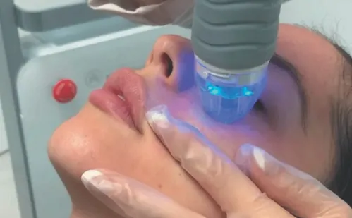 
          Imagem ilustrativa da imagem Técnicas sem cortes para olhar mais jovem e natural: as novidades da estética
          