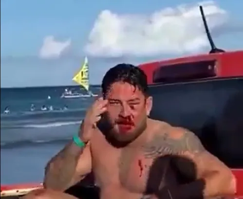 
          Imagem ilustrativa da imagem Prefeitura interdita barraca onde casal de turistas foi agredido em Porto de Galinhas
          