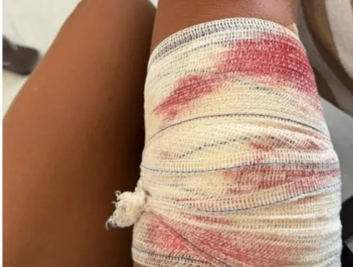 
          Imagem ilustrativa da imagem Turista de SP é mordida por tubarão ao mergulhar em Fernando de Noronha
          