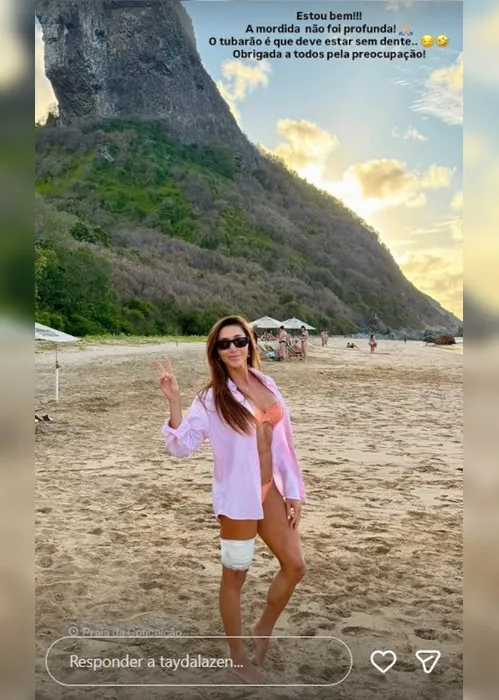 
          Imagem ilustrativa da imagem Turista de SP é mordida por tubarão ao mergulhar em Fernando de Noronha
          