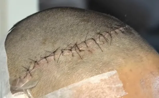 Imagem ilustrativa da imagem Adolescente sofre golpe em aula experimental de kickboxing e acaba internado na UTI