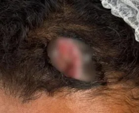 Imagem ilustrativa da imagem Mulher é resgatada de violência doméstica após denúncia anônima em Caruaru