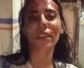 Imagem ilustrativa da imagem Mulher esfaqueia namorado e afirma ter sofrido violência doméstica: ‘De homem eu não apanho mais’