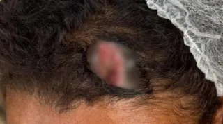 Imagem ilustrativa da imagem Mulher é resgatada de violência doméstica após denúncia anônima em Caruaru