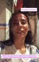 Imagem ilustrativa da imagem Mulher esfaqueia namorado e afirma ter sofrido violência doméstica: ‘De homem eu não apanho mais’