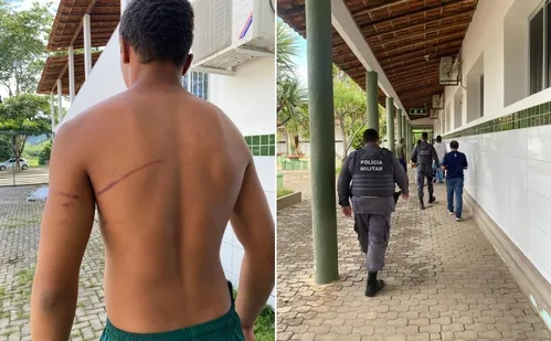 
          Imagem ilustrativa da imagem Estudante de 15 anos é agredido por colegas em internato no Noroeste do ES
          