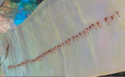 
          Imagem ilustrativa da imagem Família encontra mais de 50 escorpiões dentro de casa
          