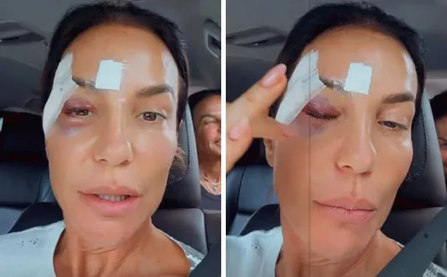 
          Imagem ilustrativa da imagem Ivete Sangalo recebe alta hospitalar e revela diagnóstico de síndrome vasovagal
          