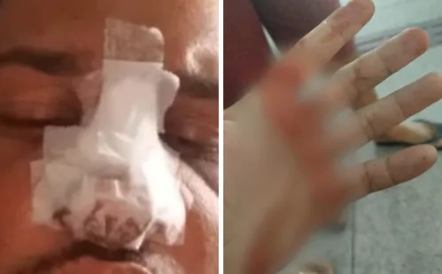 
          Imagem ilustrativa da imagem Jovem tem nariz quebrado após agressão dentro de coletivo em Vila Velha
          