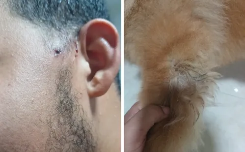 
          Imagem ilustrativa da imagem Pitbull ataca jovem e chow-chow duas vezes no Perocão, em Guarapari
          