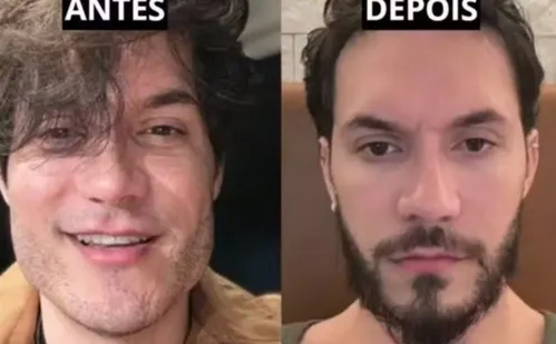 
          Imagem ilustrativa da imagem Tratamentos estéticos: mais mulheres buscam ajuda após exageros
          