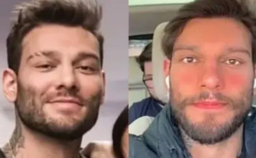 
          Imagem ilustrativa da imagem Tratamentos estéticos: mais mulheres buscam ajuda após exageros
          