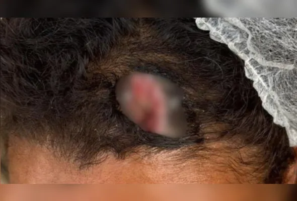 Imagem ilustrativa da imagem Mulher é resgatada de violência doméstica após denúncia anônima em Caruaru