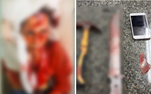 
          Imagem ilustrativa da imagem Homem joga água quente, esfaqueia e dá marteladas em ex-mulher por ciúmes
          