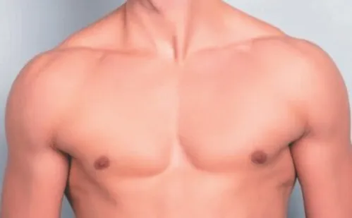 
          Imagem ilustrativa da imagem Mais de 8 mil adolescentes buscam cirurgias plásticas no ES
          